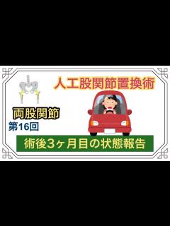 [x]手術後3ヶ月目の状態報告 - YouTube